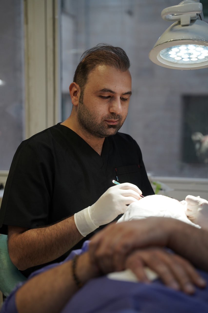 مراقبت تخصصی در فرایند کاشت مو